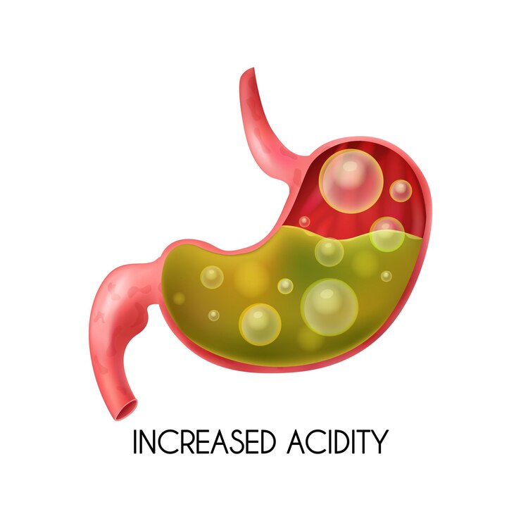 Get Quick Relief From Acidity Gas